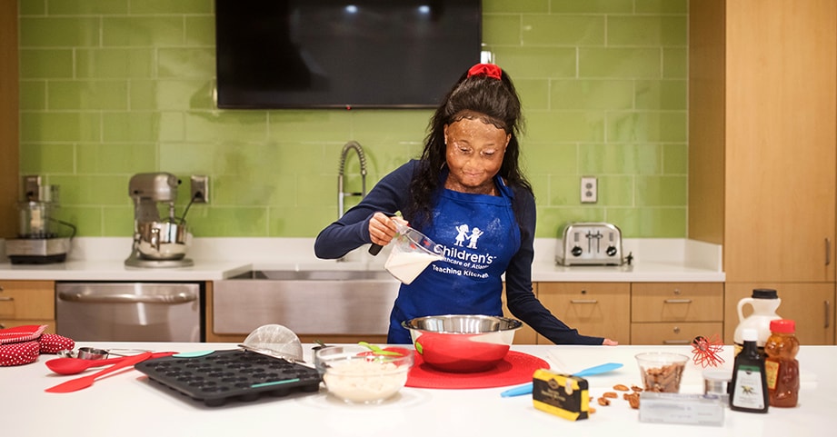 Pediatric sickle cell teen patient learning to cook