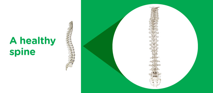 An illustration of a child's healthy spine. 