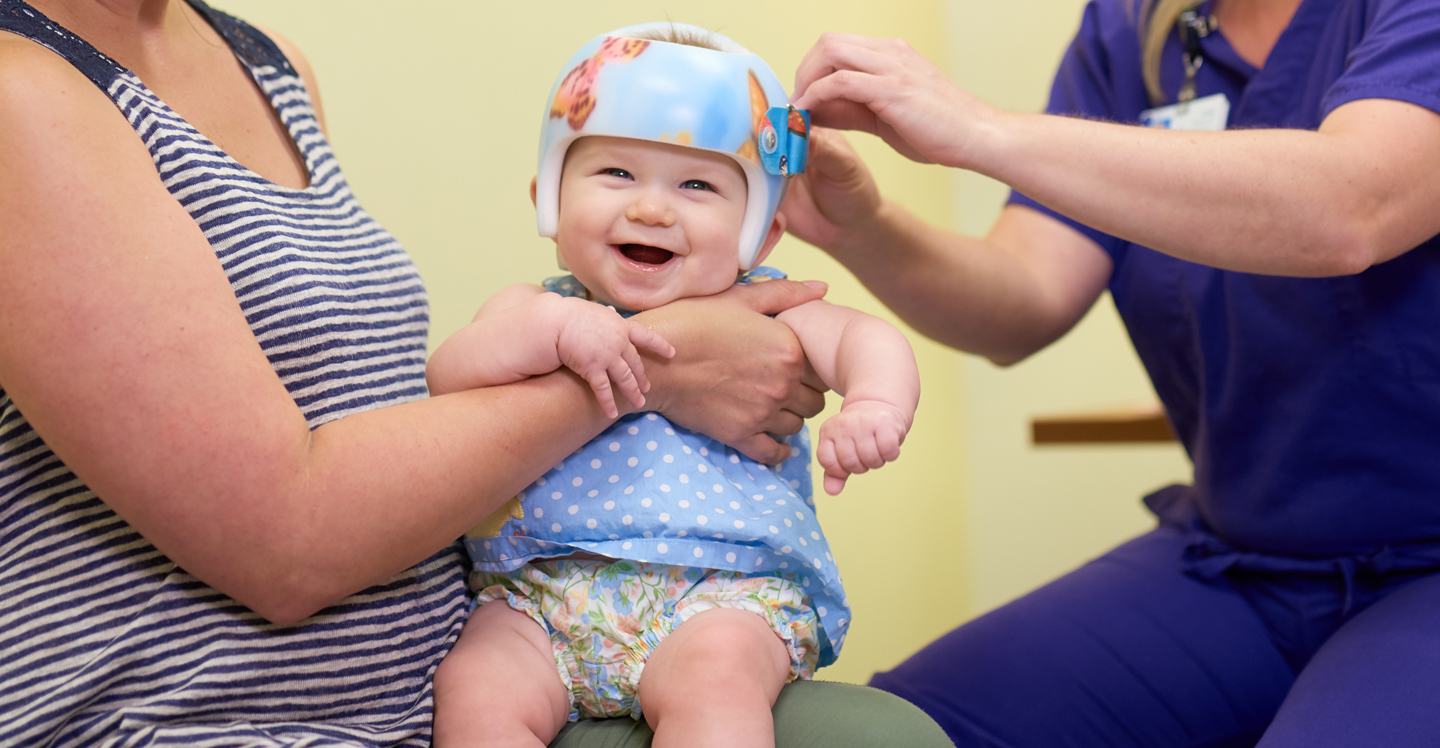 Orthotist adjusts cranial remolding helmet on a baby